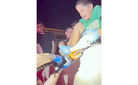 DUVARA TIRMANAN ÇOCUĞUN BACAĞINA DEMİR SAPLANDI