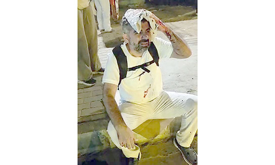 HÜDA PAR’LI DİNÇ, MISIR’DA SALDIRIYA UĞRADI