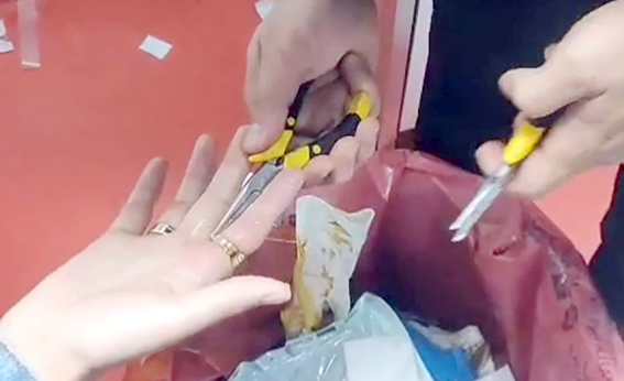 İTFAİYEDEN YÜZÜK ÇIKARMA OPERASYONU