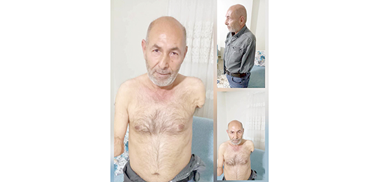 SELİM ÇETİN’İN AİLESİ SORUYOR “NEDEN TAM BAĞIMLI SAYILMIYOR?”
